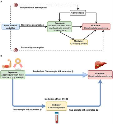 Causal association of sarcopenia with hepatocellular carcinoma risk in European population: a Mendelian randomization study